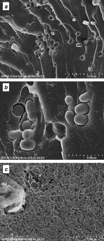 Sem Images Of Pva Cryogel Immobilized R Ruber Cells At Low A B And