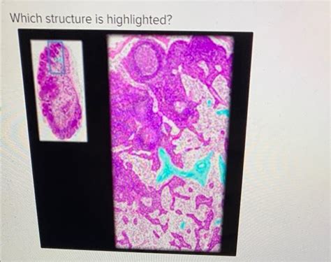 Solved Which structure is highlighted? cortex of lymph | Chegg.com