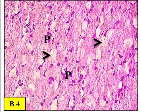 Light micrographs of the control group (B 1) rat brain (cerebral ... 
