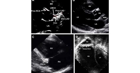 American Society Of Echocardiography Shares Updated Expert