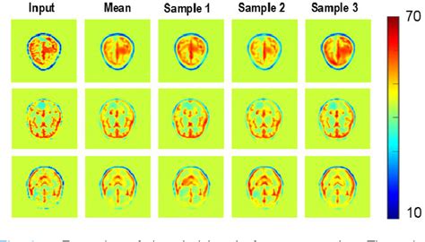 Figure 6 From Three Dimensional Microwave Data Inversion In Feature