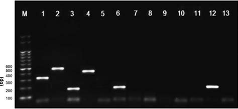 Results Of Multiplex Reverse Transcription Rt Pcr With Clinical