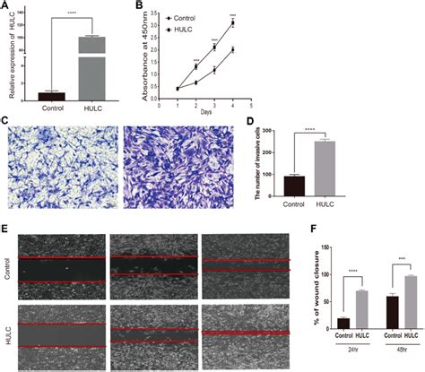 Lncrna Hulc Promoted The Malignant Behaviors Of Gbm Cells Notes A