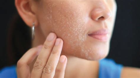 10 Magical Ways To Prevent Dry Skin In Winter Article Beats