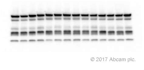 Total Oxphos Rodent Wb Antibody Cocktail Ab Abcam