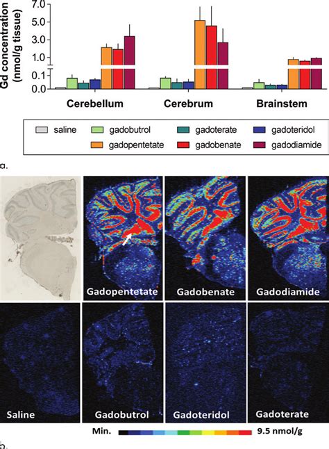 Gadolinium Gd Presence In Rat Brain After Repeated Administration Of