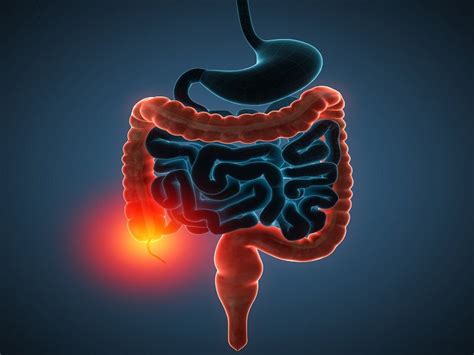 Omvoh (mirikizumab-mrkz) for the Treatment of Active Ulcerative Colitis ...