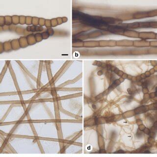 Hyphal Morphology Of Three Families Of Sooty Moulds And A Typical