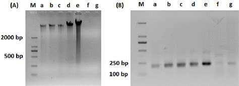 Agrose Gel Electrophoresis Of A Total DNA Extracted From Water