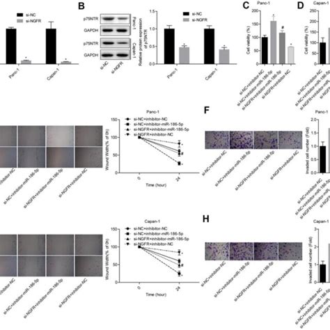 MiR 186 5p Inhibits The Migration And Invasion Of Pancreatic Cancer By