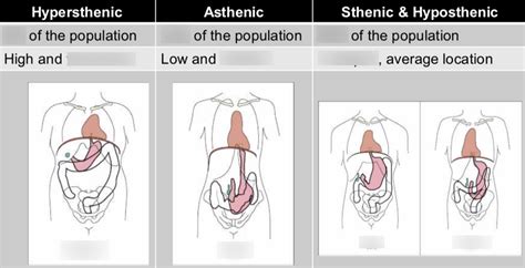 Rtca 121 Week 10 Esophagus Ugi Sbs Body Habitus Diagram Quizlet