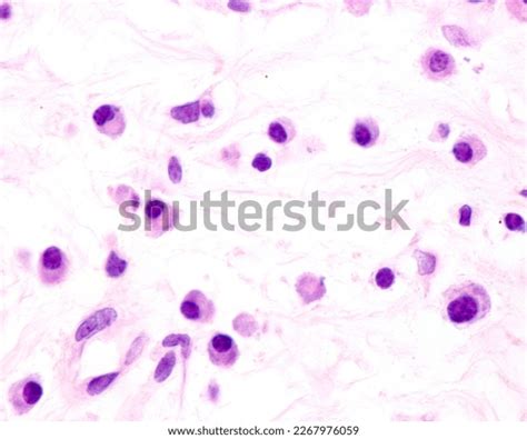 Human Plasma Cells Chronic Inflammation This Stock Photo 2267976059 ...