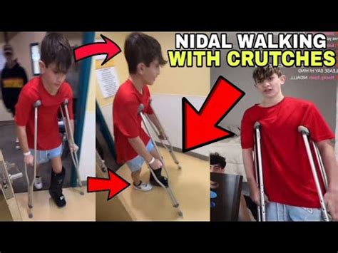 Nidal Wonder IS NOW WALKING With CRUTCHES After His TERRIBLE CAR