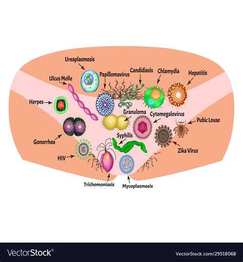 Viral And Bacterial Infections Sexually Royalty Free Vector