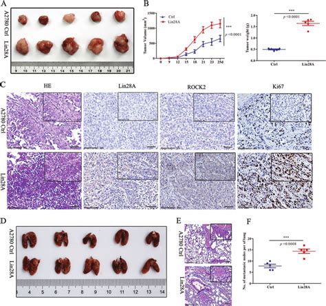 Lin A Promoted The Tumor Growth And Metastasis Of Oc Xenograft In