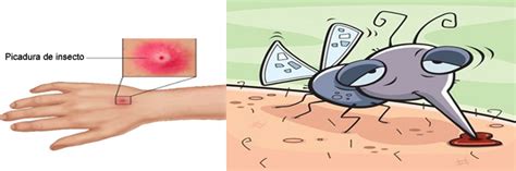 Como Prevenir Y Tratar Las Picaduras De Insectos Fumigadora Continente