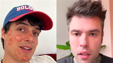 Fedez E Luis Sal Trovato Accordo Economico Per Muschio Selvaggio L