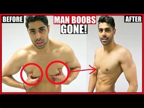 How To Get Rid Of MAN BOOBS CHEST FAT LOSS YouTube