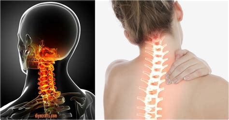 Neck Pain Treatment: This Unusual Stretch Relieves Stiff Neck in 90 Seconds! - DIY & Crafts