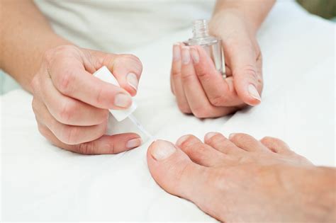 Fungal vs psoriatic nails