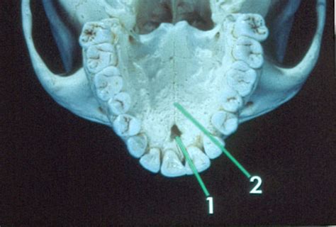 Normal Intraoral Anatomy Pictures Lecture Flashcards Quizlet