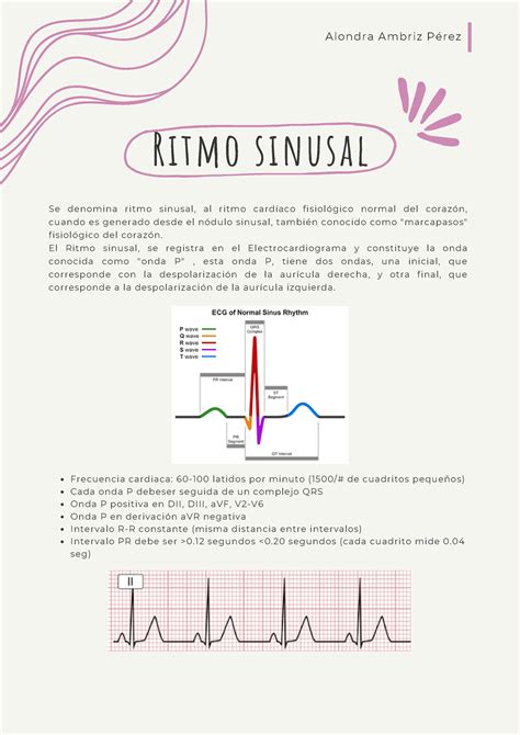 Ritmo Sinusal Ritmo Sinusal Se Denomina Ritmo Sinusal Al Ritmo