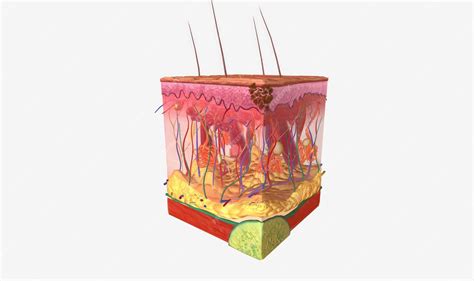 Premium Photo | The melanoma epidermis stage 0