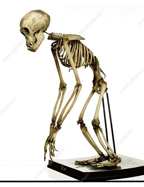 Chimpanzee Skeleton Stock Image C0236674 Science Photo Library