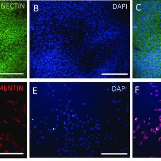 Immunofluorescence staining: Following cell proliferation ...