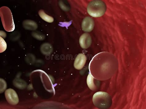 Diseased Blood Cells Stock Illustration Illustration Of Artery 146232978