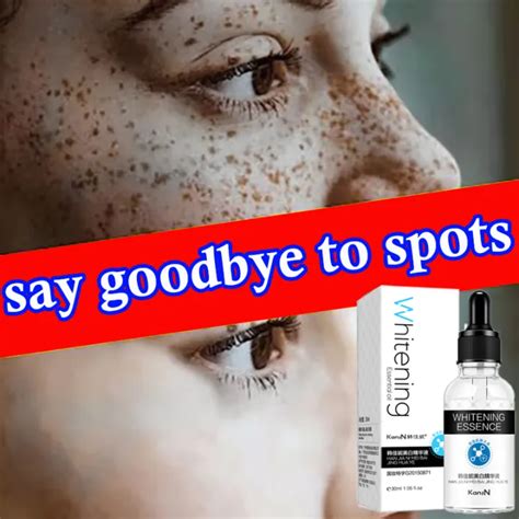 Effective Whitening Freckle Cream Serum Remove Freckle Speckle Fade