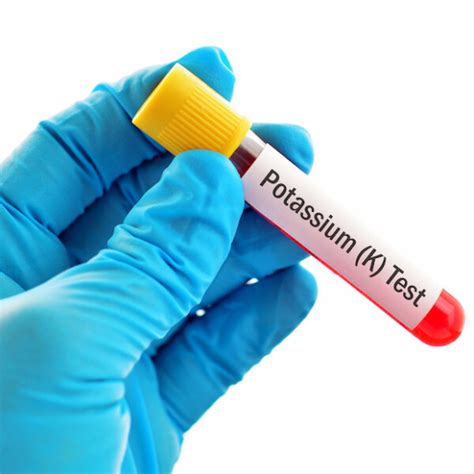 Potassium Serum Test Best Pathology Lab And Diagnostic Centre