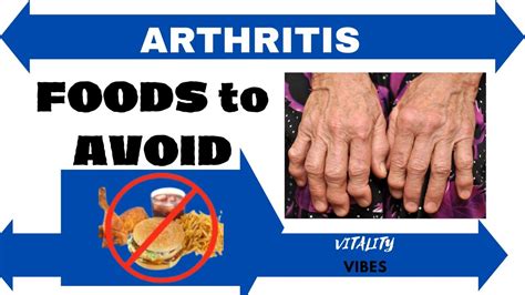 Unlocking Joint Health Top 6 Foods To Steer Clear Of For Arthritis