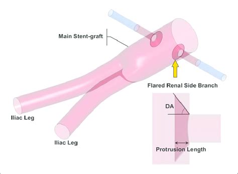 Schematic Of The Flared Fenestrated Stent Graft Fsg The Main Download Scientific Diagram