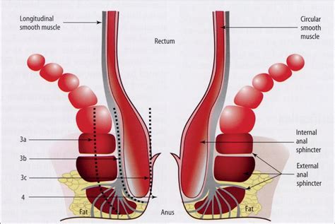Obstetric Anal Sphincter Injuries OASIS Halo Medical Technologies