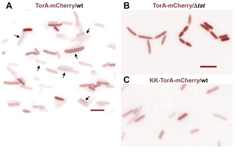 A Fluorescence Micrograph Of E Coli Bl21de3 Cells Expressing