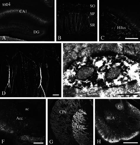 Immunofluorescent And Electron Micrographs Showing The Regional And