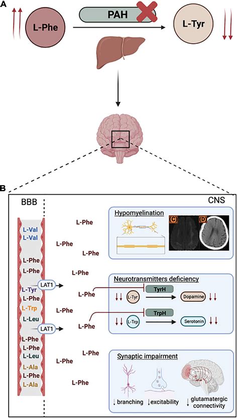 Frontiers Engineering Organoids For In Vitro Modeling Of Phenylketonuria