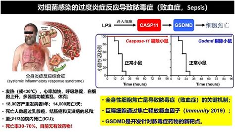 写意报告丨邵峰：细胞焦亡如何为肿瘤免疫带来新突破？ 邵峰院士在第二届同写意大会上作报告 7月9 11日，苏州国际精英创业周园区分会场——“网页