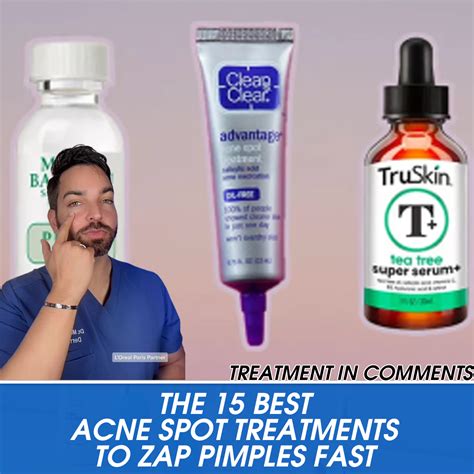 The Best Acne Spot Treatments To Zap Pimples Fast Recipe Ideas