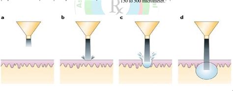 Figure From Review On Needle Free Injection Technology Semantic Scholar