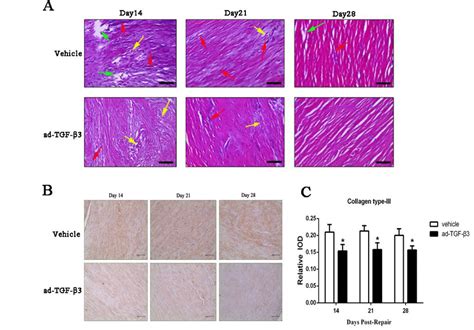 HE Staining And Collagen Type III Immunohistochemistry Staining A HE