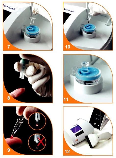 Quo Lab A1c Test Kit Allmed