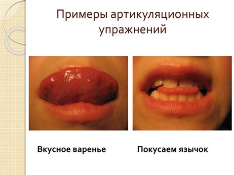 Коррекция звукопроизношения у детей - online presentation