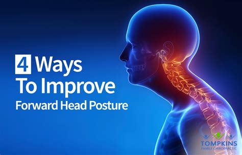 Forward Head Posture Corrected In 4 Simple Steps Tucson Chiropractor