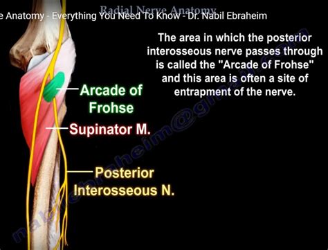 Posterior Interosseous Nerve Release —