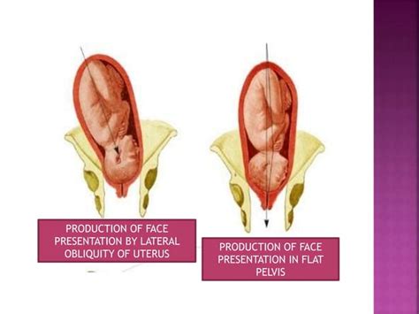 Face presentation