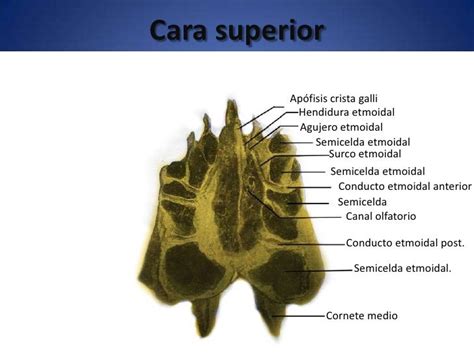 Osteología Del Cráneo Frontal Y Etmoides