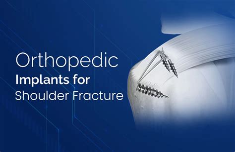 Shoulder Fracture Overview Types And Implants Zealmax Innovations