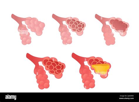 Set Of Human Alveoli Cartoon Design Human Anatomy Organ Vector Illustration On White Background